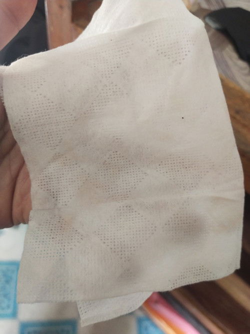 Normal lang ba magka brownish discharge sa first trimester kahit di sumakit ang puson or ang tyan?