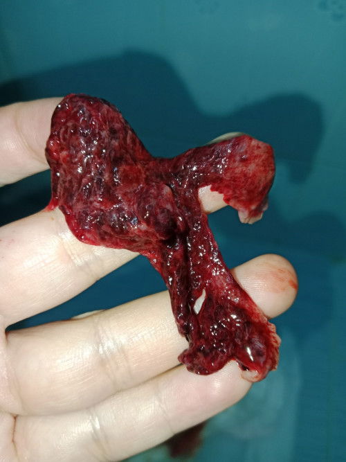 แบบนี้ผิดปกติมั้ยคะ ประจำเดือนหลังคลอด4เดือน