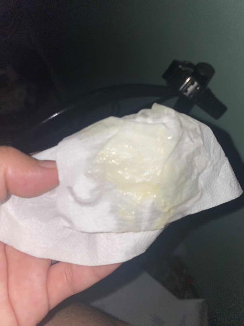air ketuban atau keputihan ?