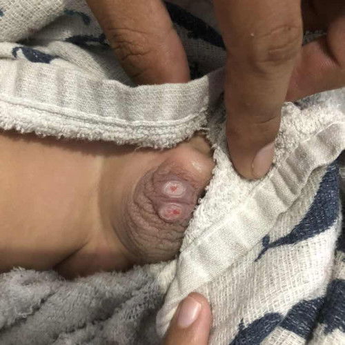Anaku kenapa ya?