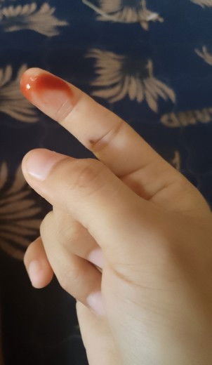 Week 6 keluar darah