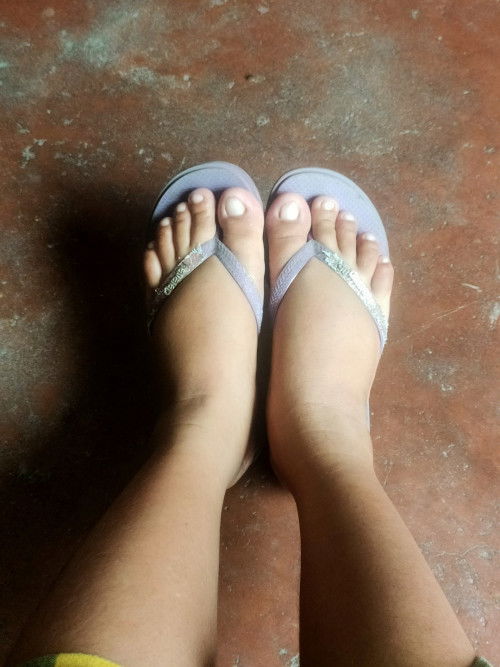 Swollen Feet