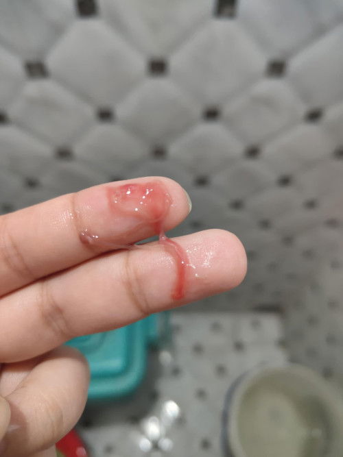 Pasintabi po sa mga na kain anu po ibig sabihin pag ganito discharge?natatakot na po KC ako 8weeks