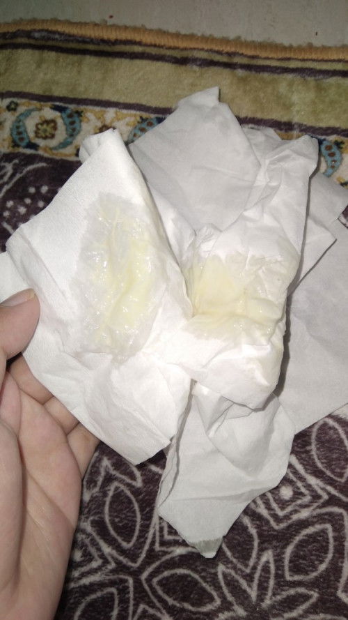 Bun aku hamil 22 week terus pagi tadi pas bangun keluar kaya gini. Gimana ya?