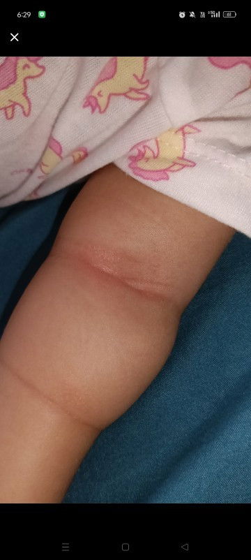 RUAM PANAS KE NI?