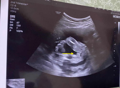 BOY OR GIRL NI 🥹 ?