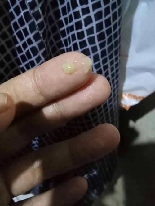 Bun barusan aku keluar lndir gtu ini lendir apa ya atw keputihan , jdiovt 🥺baru usia 33w4d
