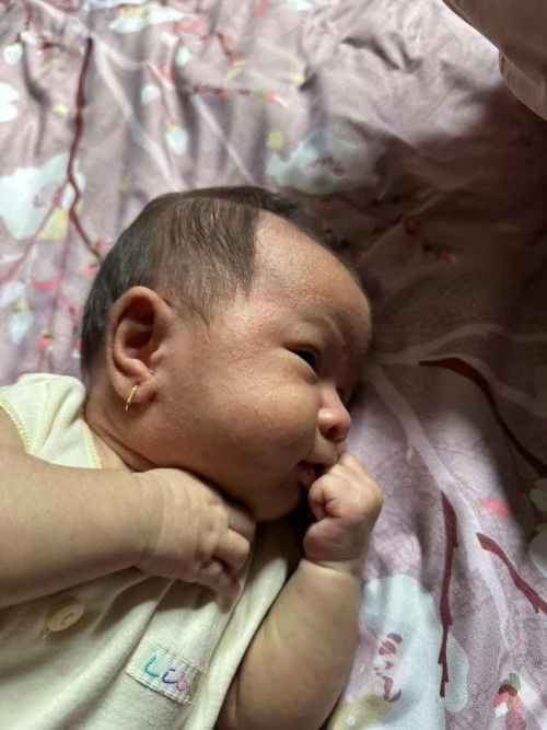 Biang Keringat di Muka