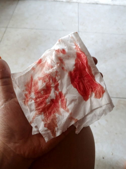 Kelainan darah