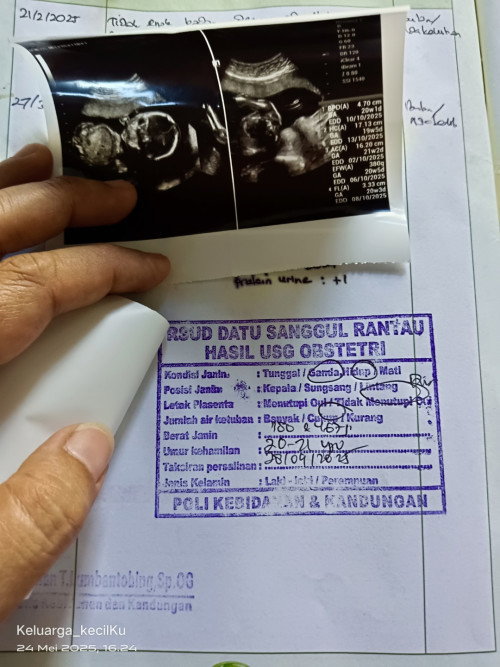 bagi pengalamannya dong bunda2 yg pernah atau lagi hamil baby twins