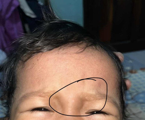 Bercak putih di dahi bayi