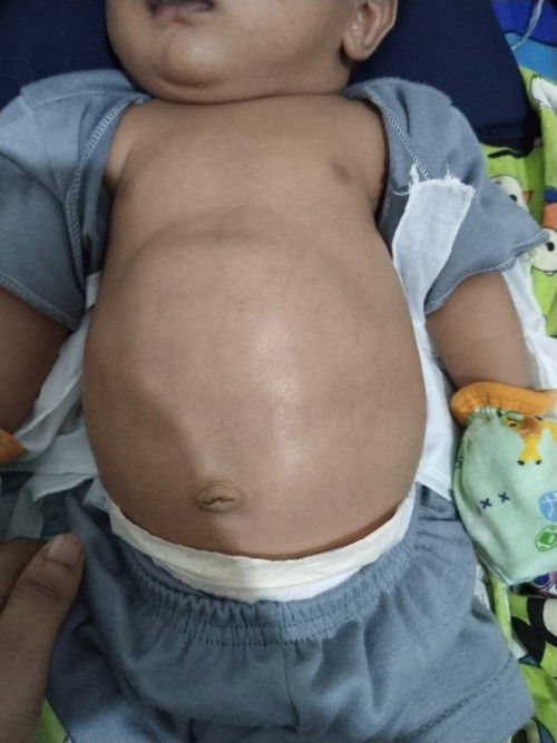 Perut bayi 30 hari