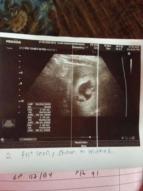 Hai mommy semua macam ini twin kah