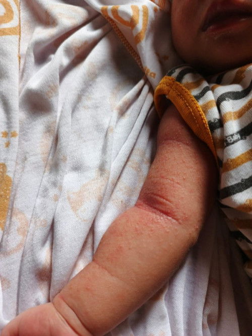Bayi 11 hari