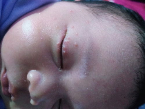 mata bayi merintis merah
