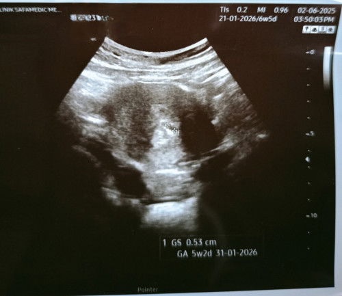 Hi ikot kiraan sy pregnt dah 6week++ tp arini scan br 5week++ scan sbb de bleding kluar skit² risau