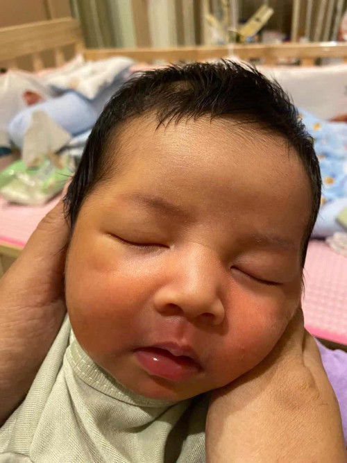 cara menumbuhkan rambut bayi
