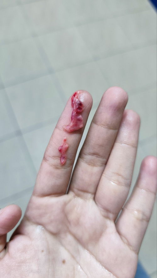 KEGUGURAN ATAU DARAH PERIOD BIASA??