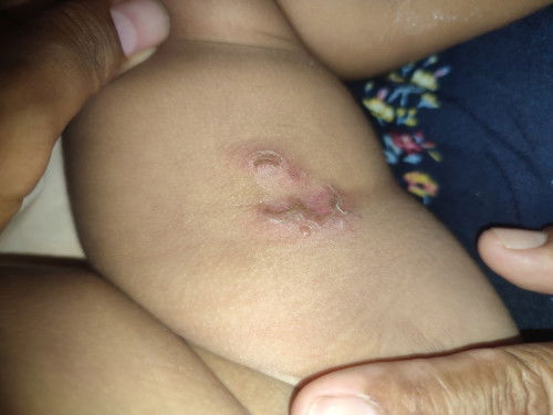 Tadinya bintik kecil malah jadi kaya gini