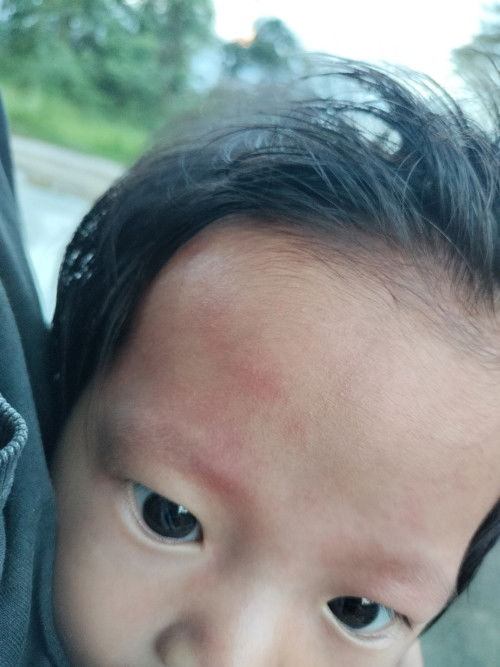 Mau tanya dong Bun 
Klo kyak gini kenapa ya Bun🥹