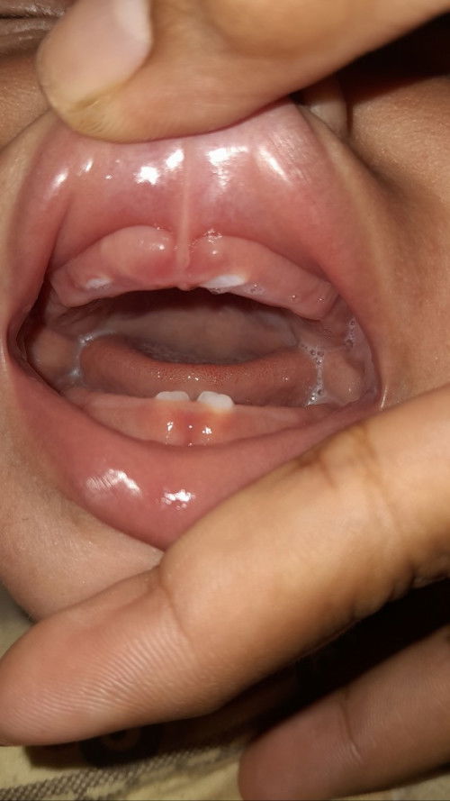 Normal gak ya