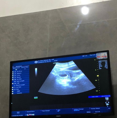 8 Minggu Masih terlihat Kantong