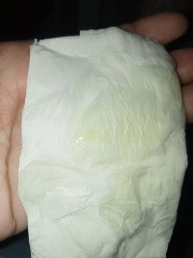Usia kandungan bidan 38
Usia kandungan hasil USG 39