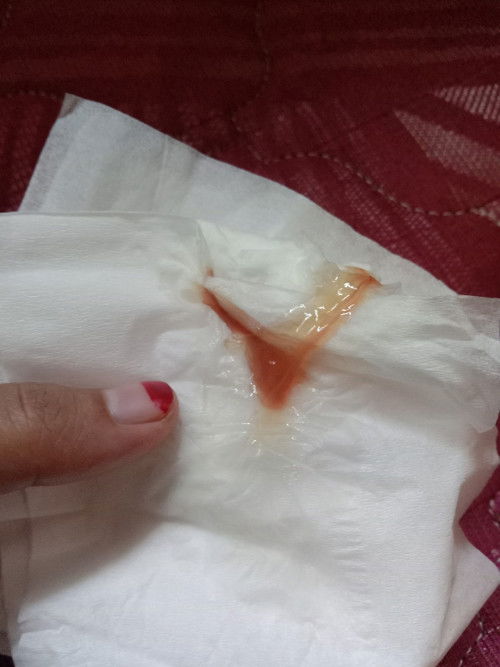 Keluar lendir darah tapi belum ada pembukaan