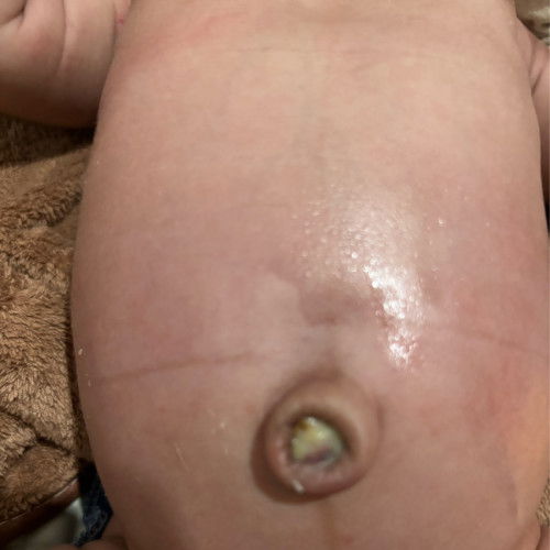 Bayi 12 hari