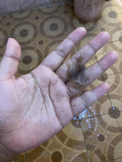 Keputihan gelap