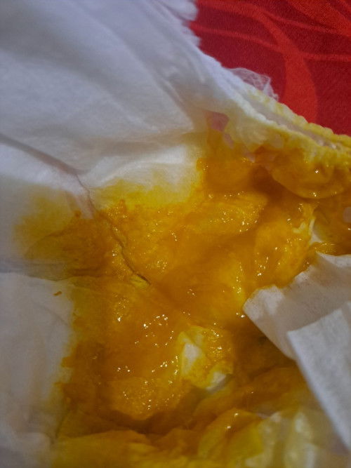 FASES BAYI 2 BULAN KUNING BERLENDIR
