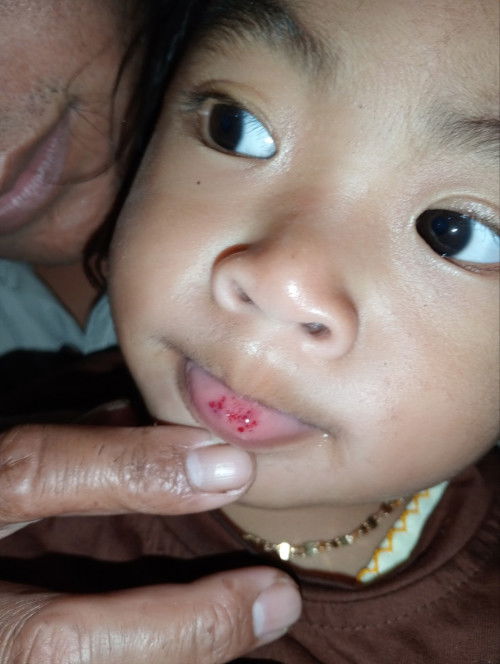 ANAK JATUH
