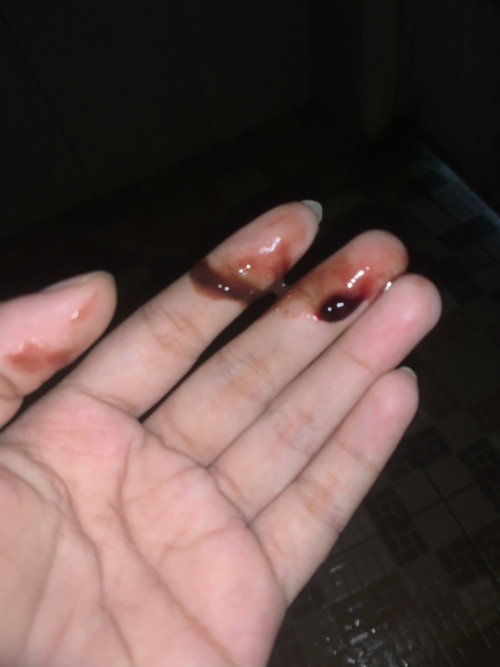 Keluar darah 37w4Day