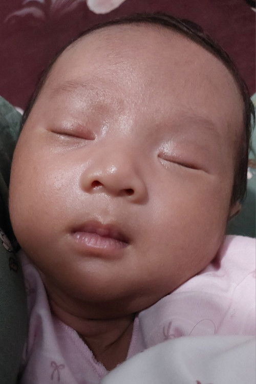 Bruntusan atau biang keringat