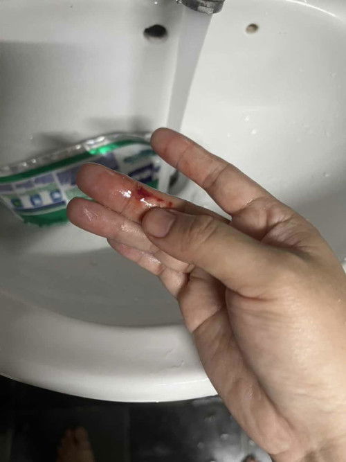 4 weeks bleeding