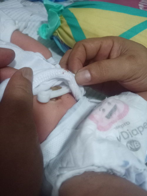 Yung pusod ni Baby