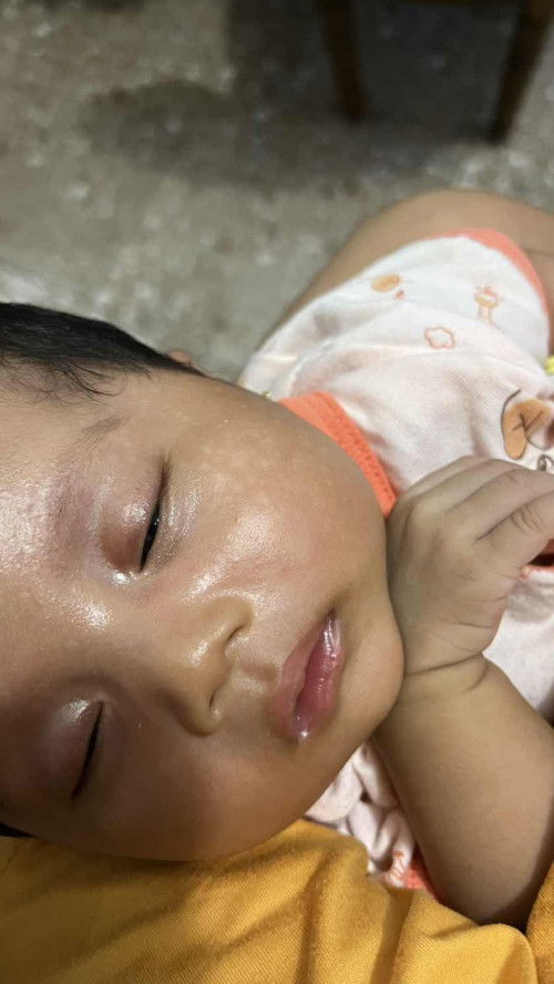 Pipi bayi bercak putih