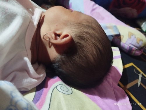 Kepala bayi seperti ini apa normal