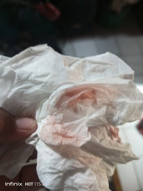 Ternyata gjadi hamil