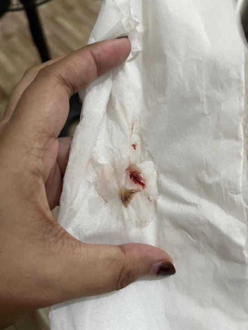 Normal po ba ito?