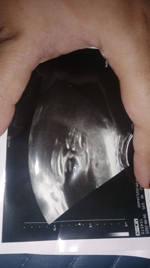 Mommy ii tolong tengok