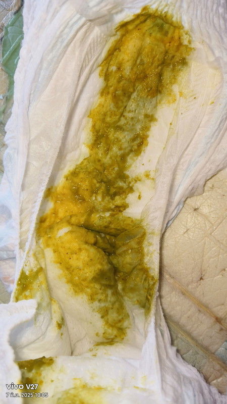 อึลูกแบบนี้ปกติมั๊ยค่ะ