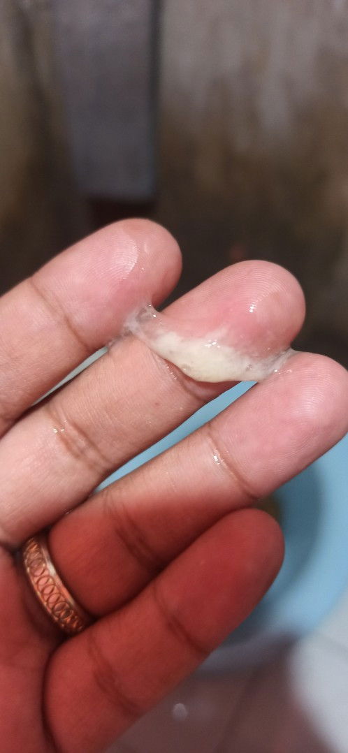 Mucus like Discharge