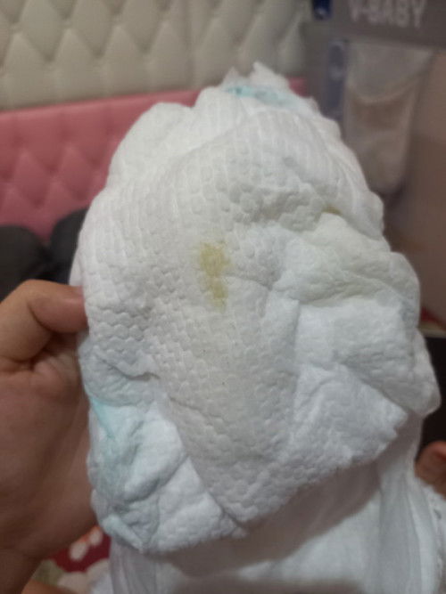 Bercak putih seperti lendir pada pipis bayi