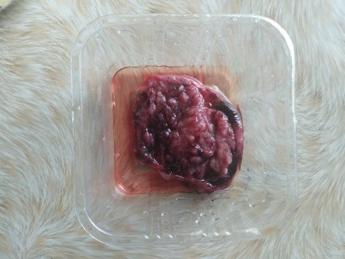 Hello po..7 wks po ako ngayon DINUGO Po ako simula kahapon..ngayon po may lumabas na ganito..