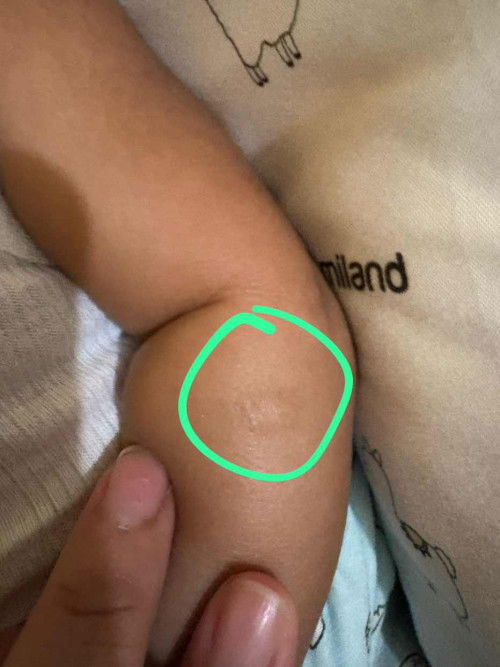 Kulit Kering