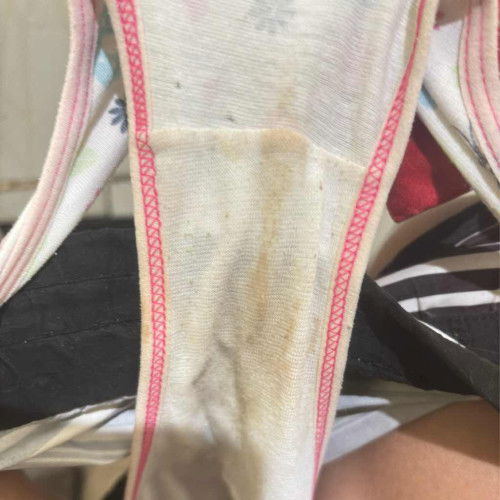 Brown Discharge