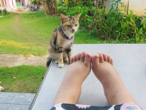 Kaki bengkak
