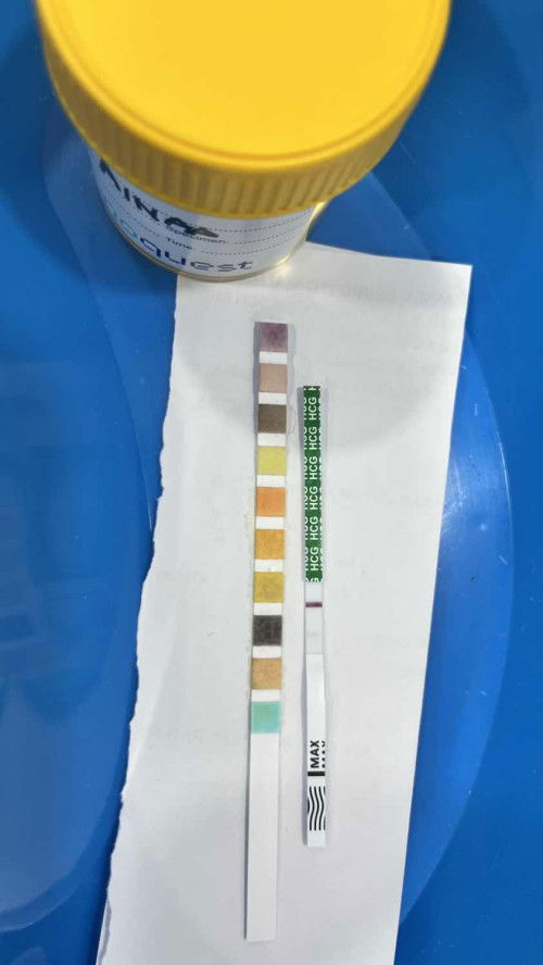Pregnancy test