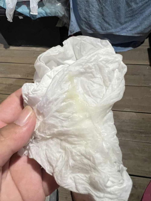 38+4 มีมูกใสเเบบนี้ ปวดท้องหน่อยๆ ใกล้จะคลอดยังค่ะ